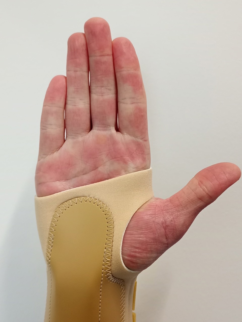 Hand Figure1