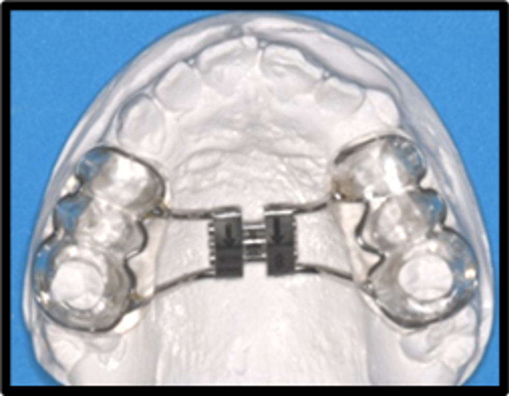 Arch Appliance Extension