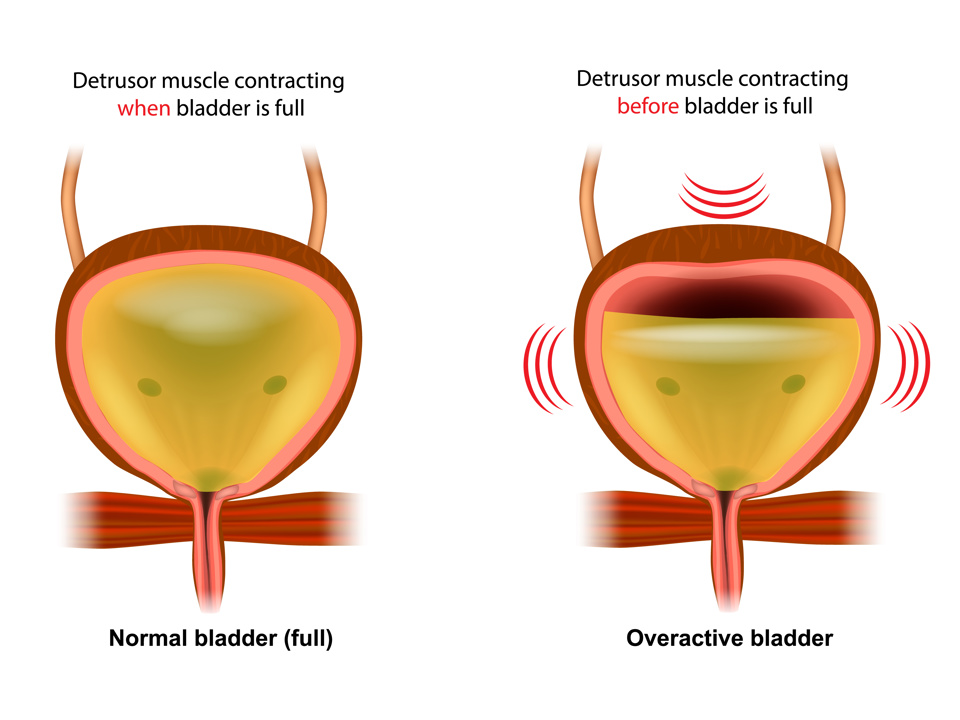 Difference in Detrusor Muscle contracting when bladder is full and empty