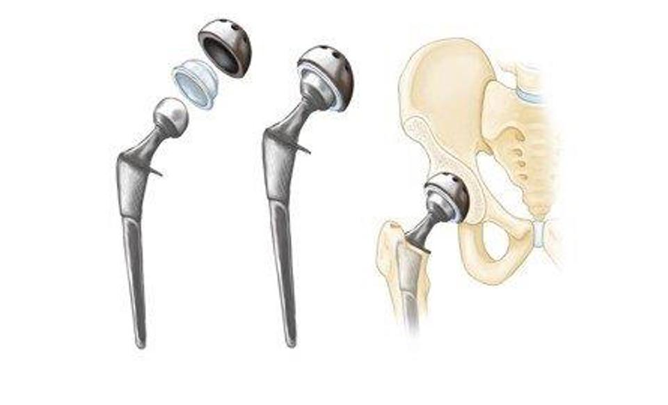 Instruments Involved In Total Hip Replacement