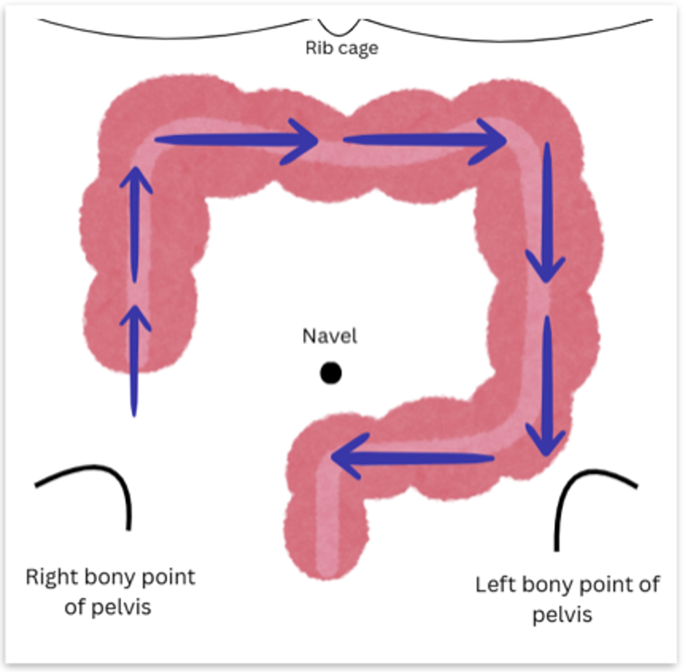 Constipation Diagram