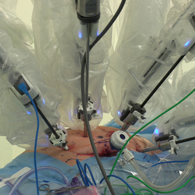 Robot operating on patient