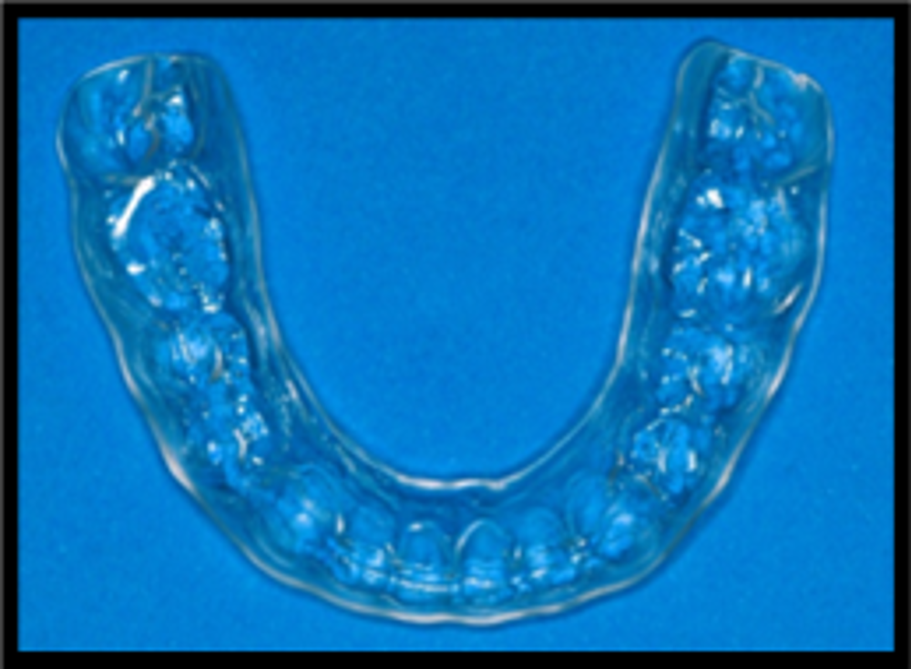 Retainers