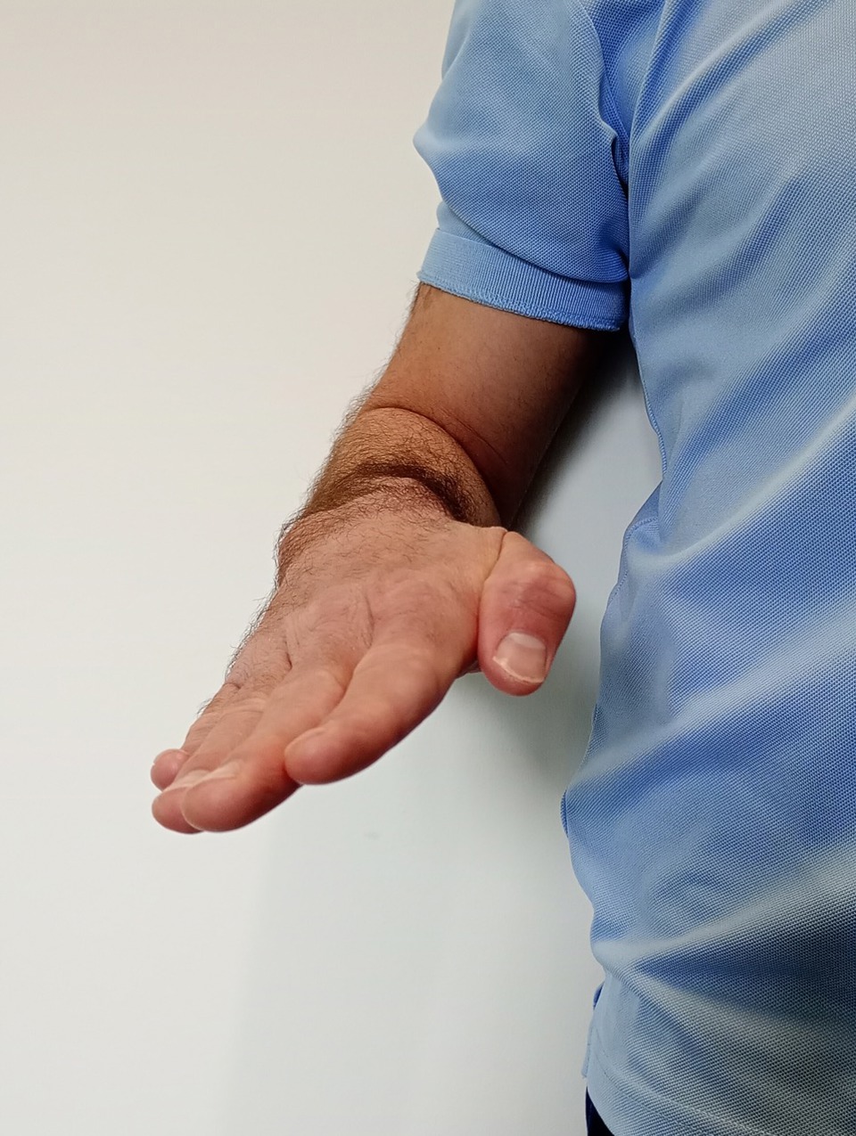 Elbow Supination 2