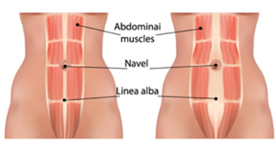 Abdominal Muscles