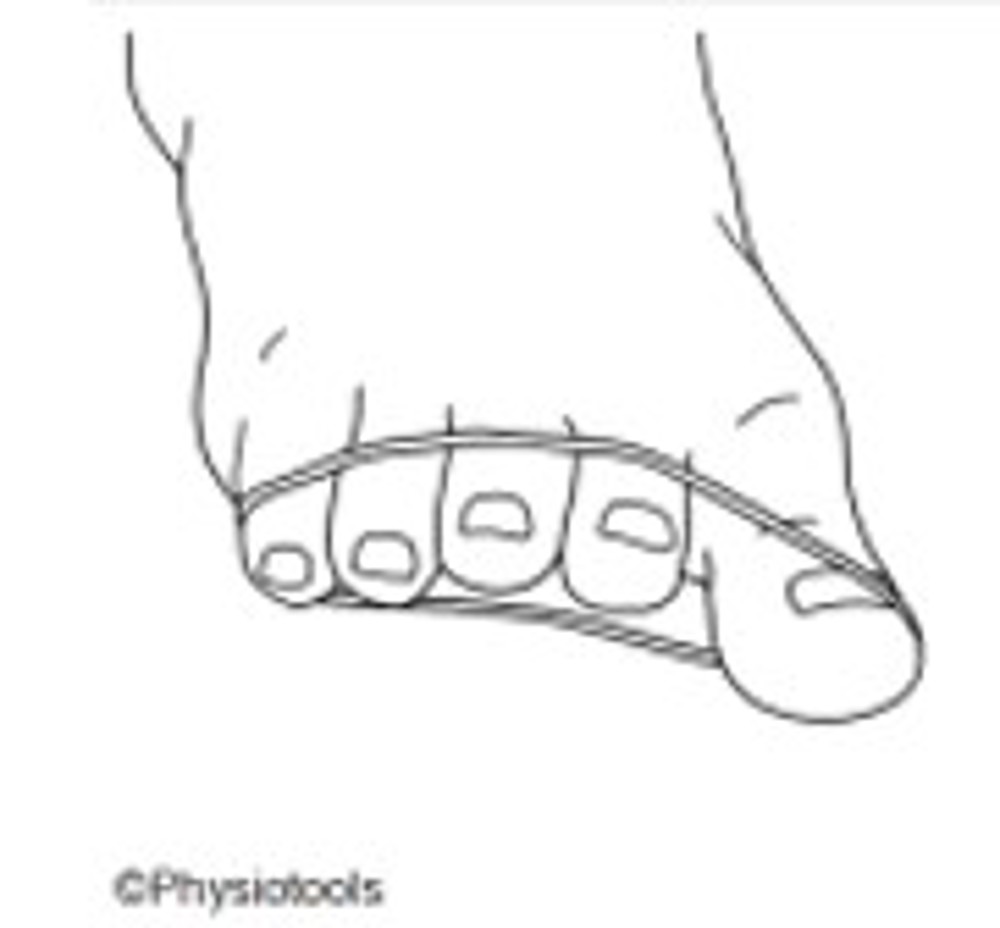 6. Intrinsic Foot Exercises