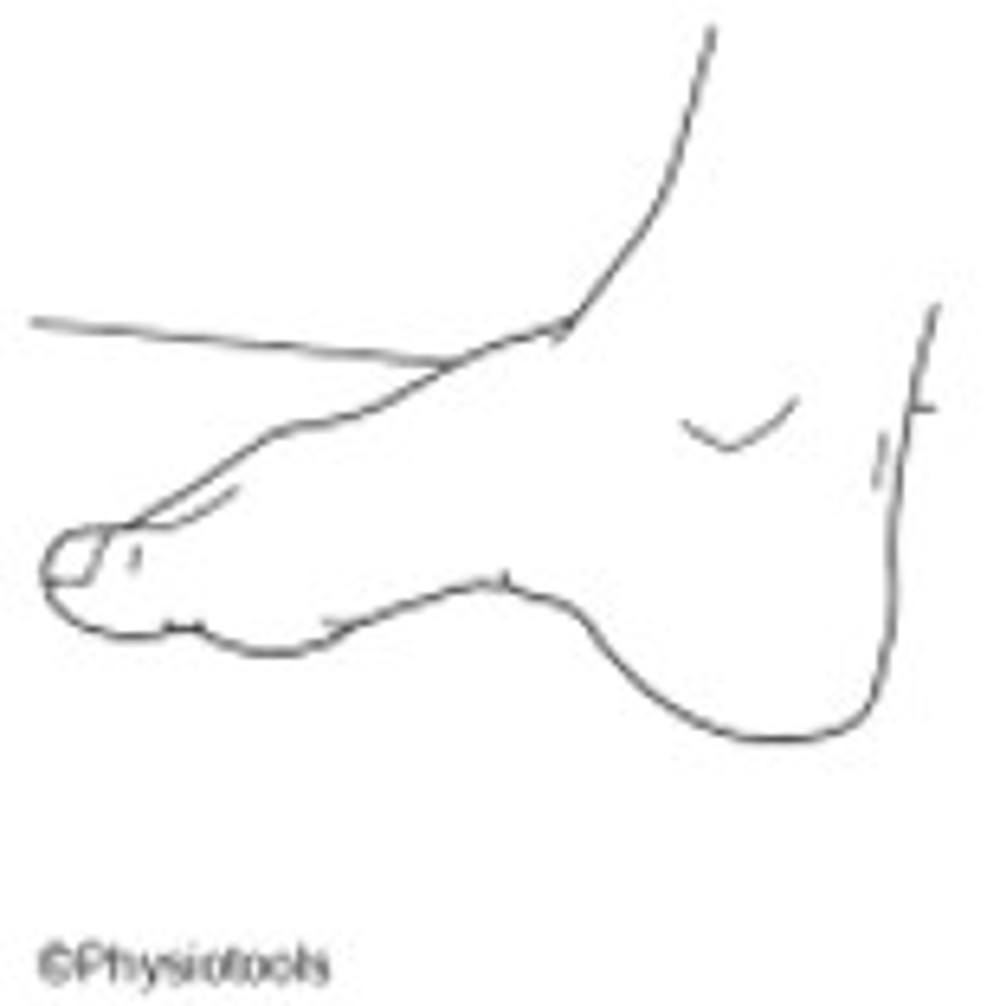 1. Intrinsic Foot Exercises