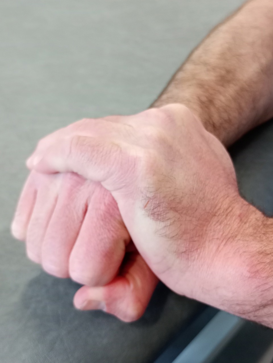 Extend Wrist Backward