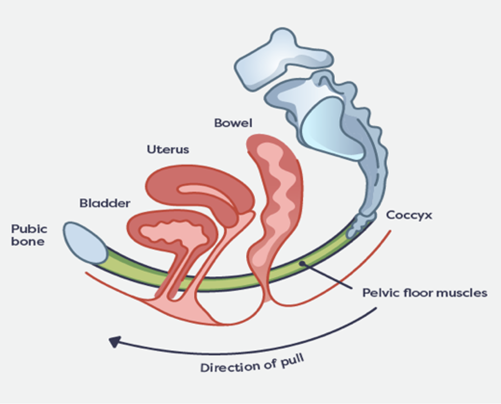 Direction Of Pull In Prolapse