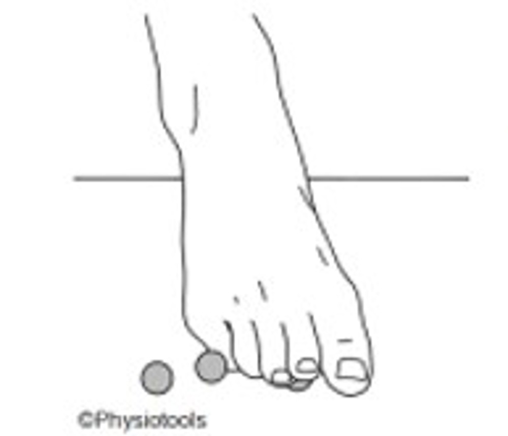 8. Intrinsic Foot Exercises