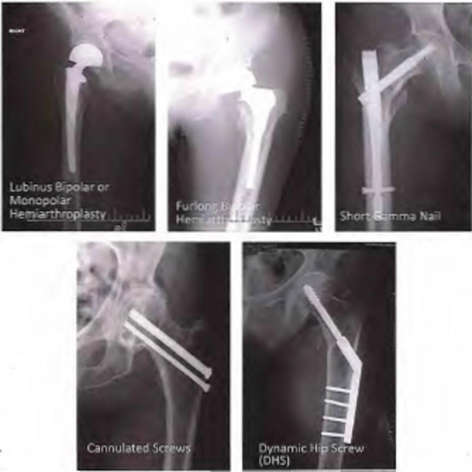 X Rays