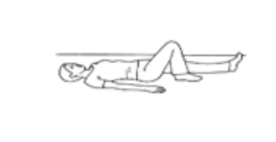 Patella Dislocation Exercise 4