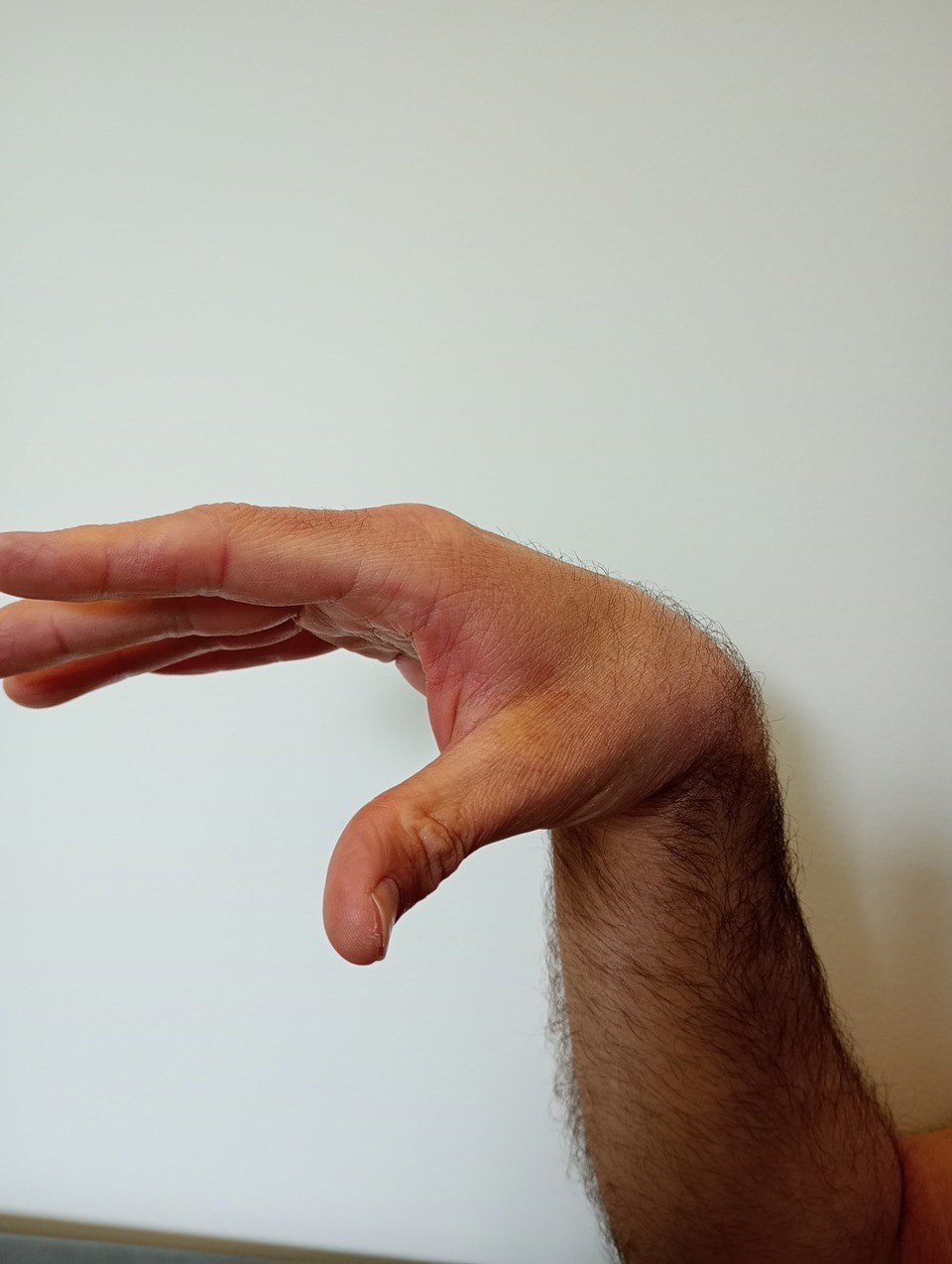 Bend Wrist Back 2