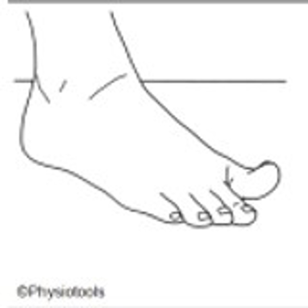 3. Intrinsic Foot Exercises