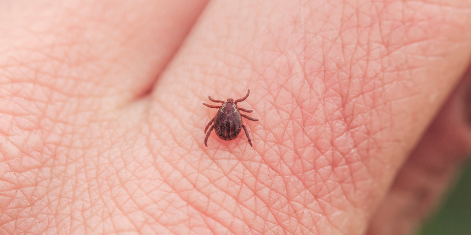 Tick on skin