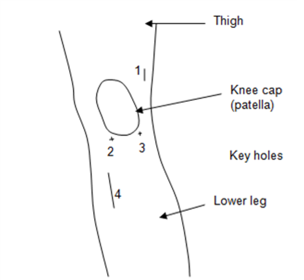Knee And Surgery Areas